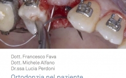 Ortodonzia nel paziente implantare: linee guida e strategie per il successo