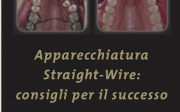 Apparecchiature Straight Wire: consigli per il successo