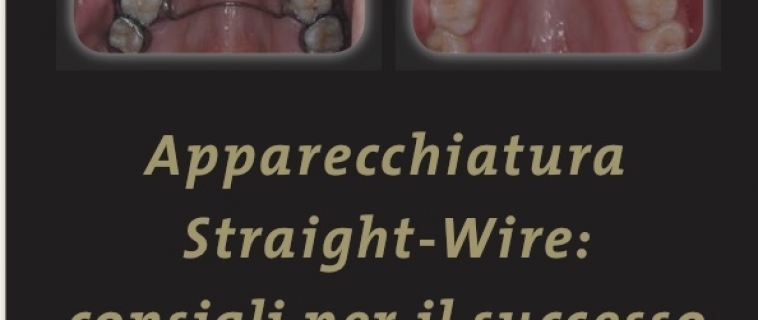 Apparecchiature Straight Wire: consigli per il successo