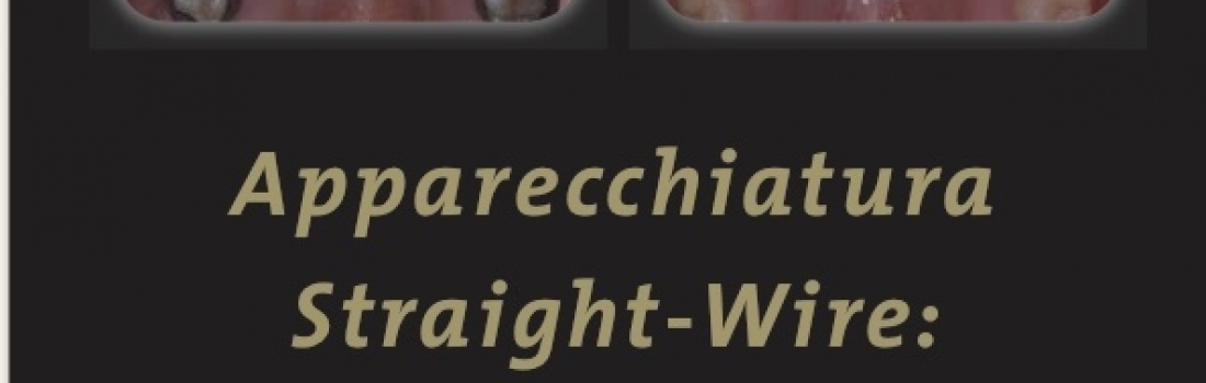 Apparecchiature Straight Wire: consigli per il successo